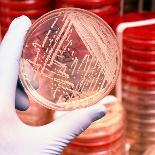 Bakterije otporne na antibiotike, ilustracija