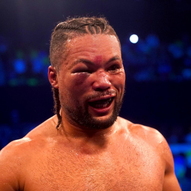 Joe Joyce