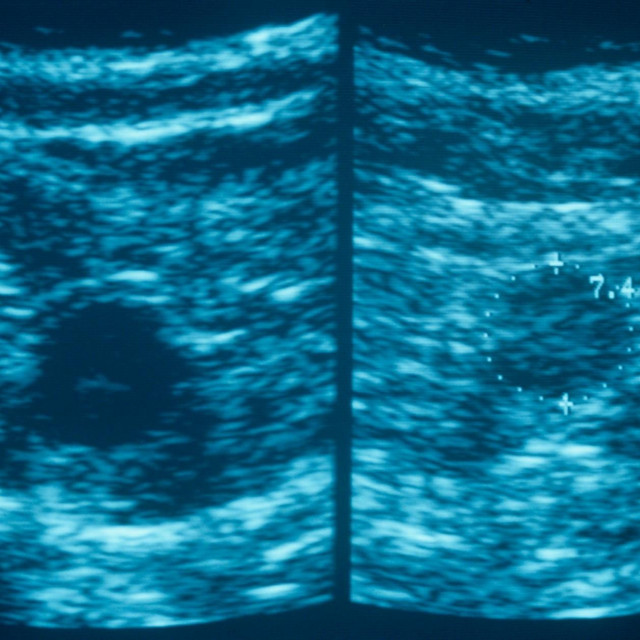 Ilustrativna fotografija