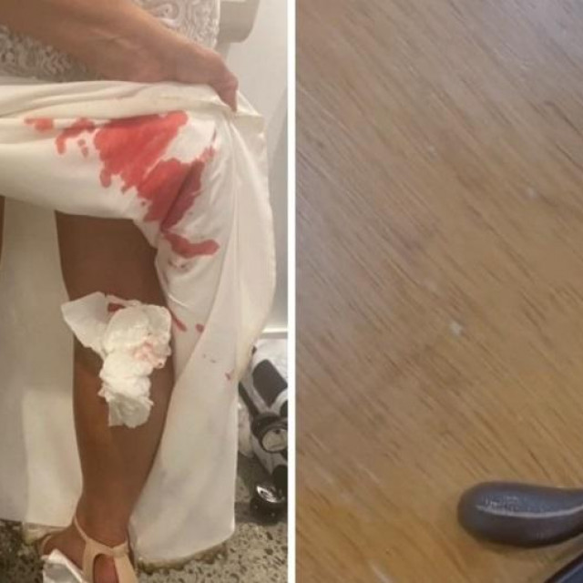 Mladenku napale pijavice