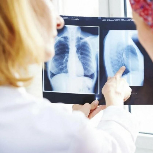 Ilustrativna fotografija