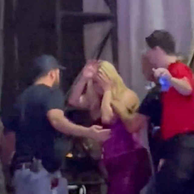 Bebe Rexha prekriva lice nakon udarca