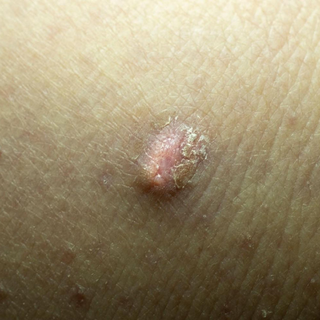 Ilustrativna fotografija