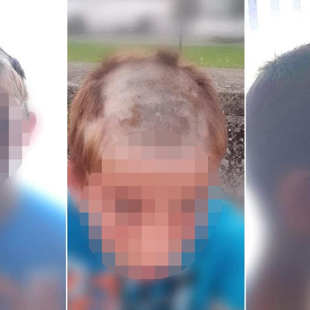 Školarac nad kojim su se iživljavala dva mladića