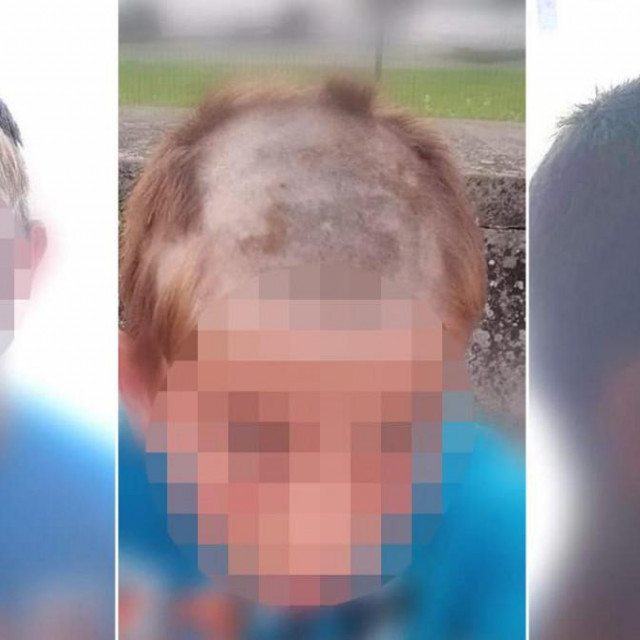 Fotografije koje je objavila majka ošišanog dječaka