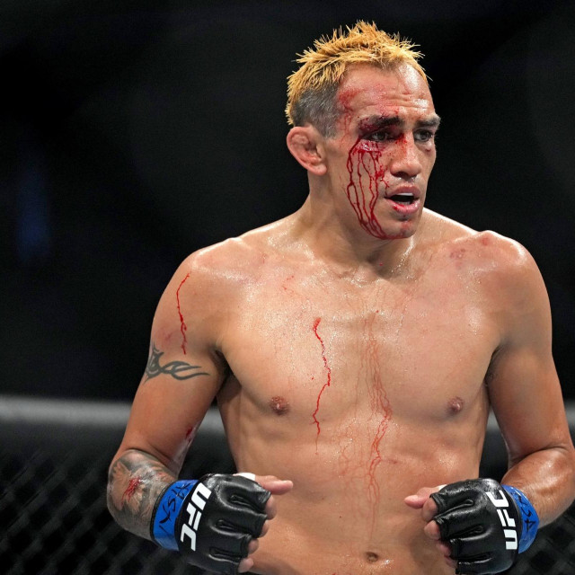  Tony Ferguson 