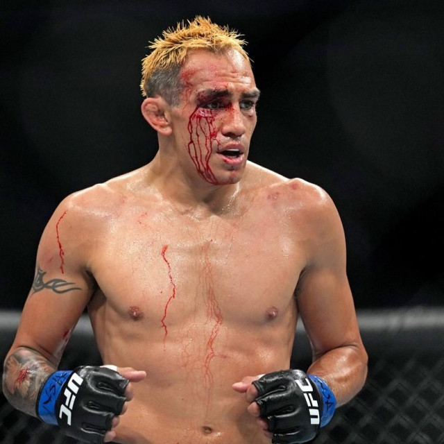 Tony Ferguson