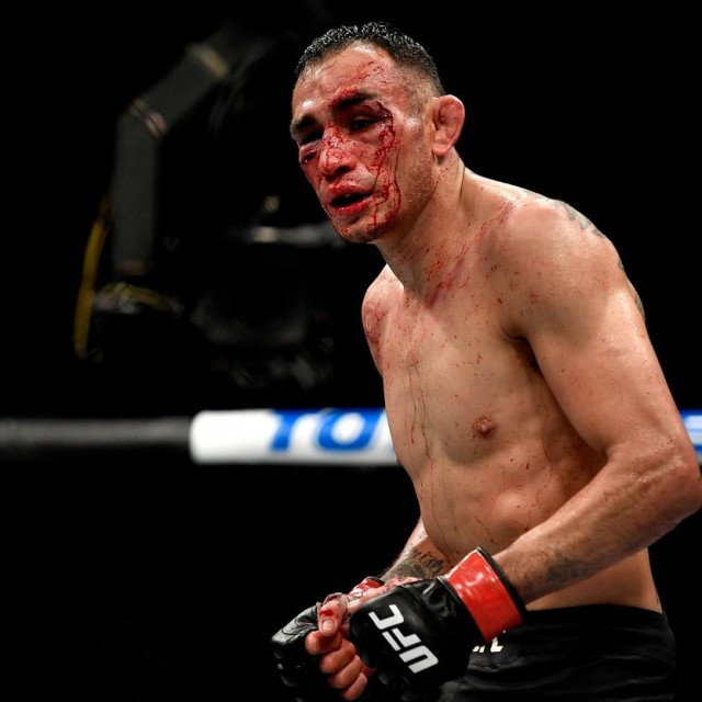 Tony Ferguson