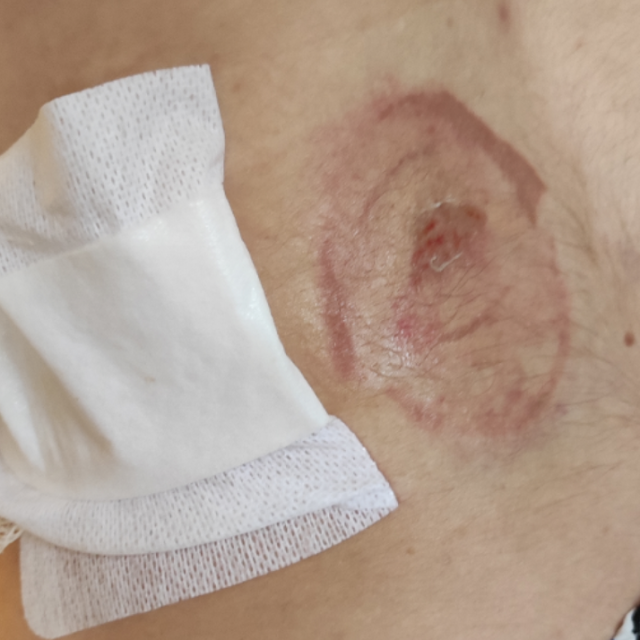 Napad morske kornjače