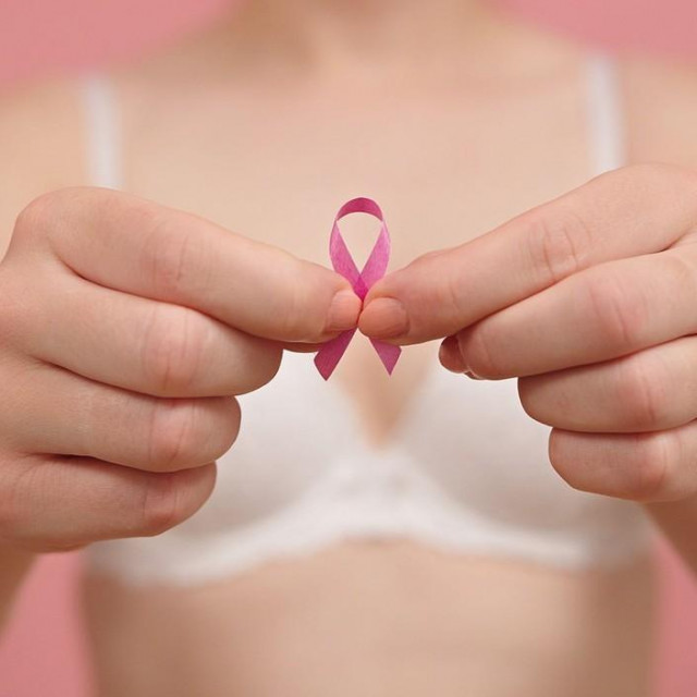 Rak dojke/Ilustracija