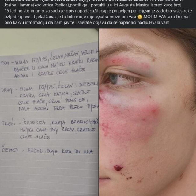 Objava majke pretučenog mladića u Dubravi