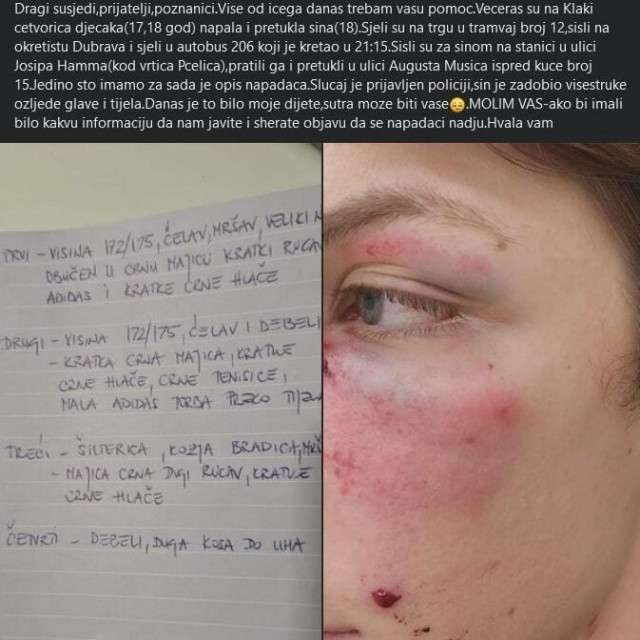 Objava majke pretučenog mladića u Dubravi