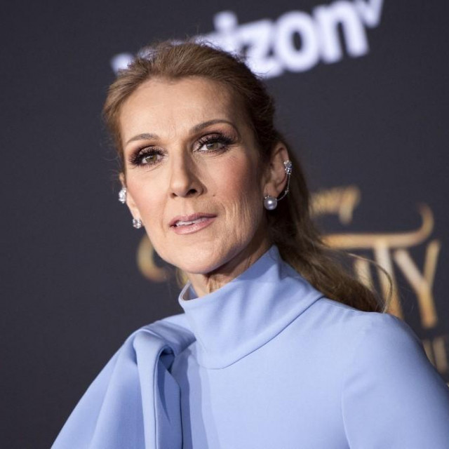  Celine Dion bori se s teškom neurološkom bolešću