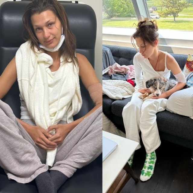 Bella Hadid i lajmska bolest