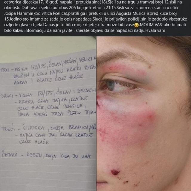 Objava majke pretučenog mladića u Dubravi