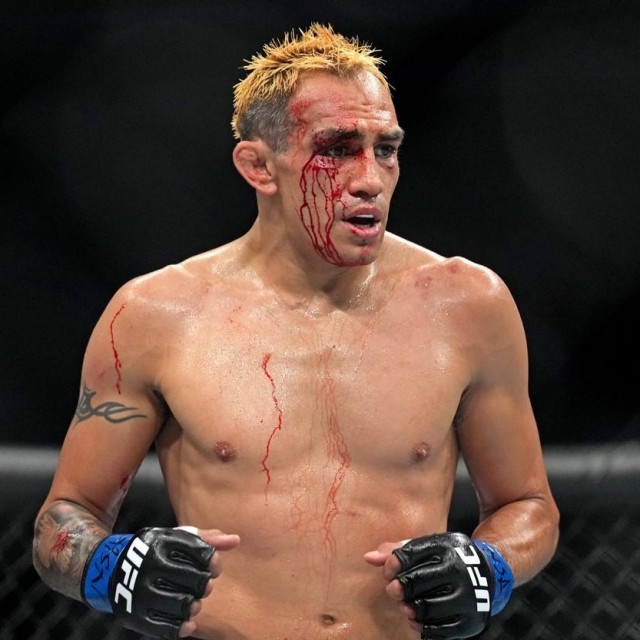 Tony Ferguson