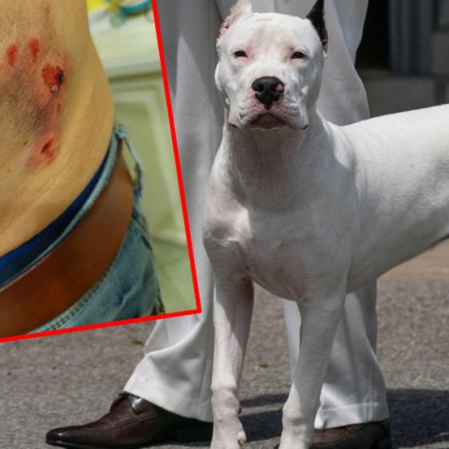 Posljedice napada argentinske doge na 63-godišnjeg mještanina Brbinja