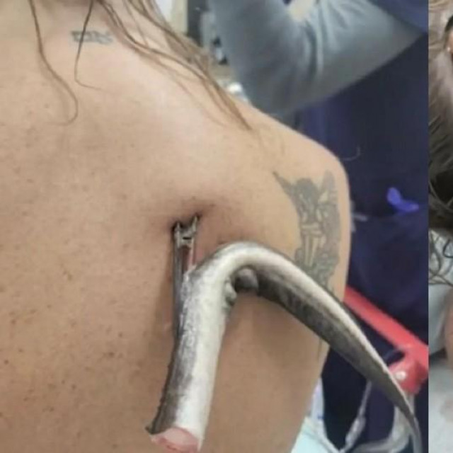 Kristie O‘Brien napala raža