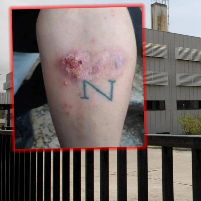 Ilustrativna fotografija