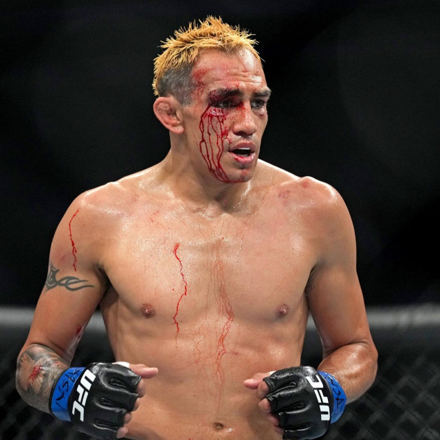 Tony Ferguson