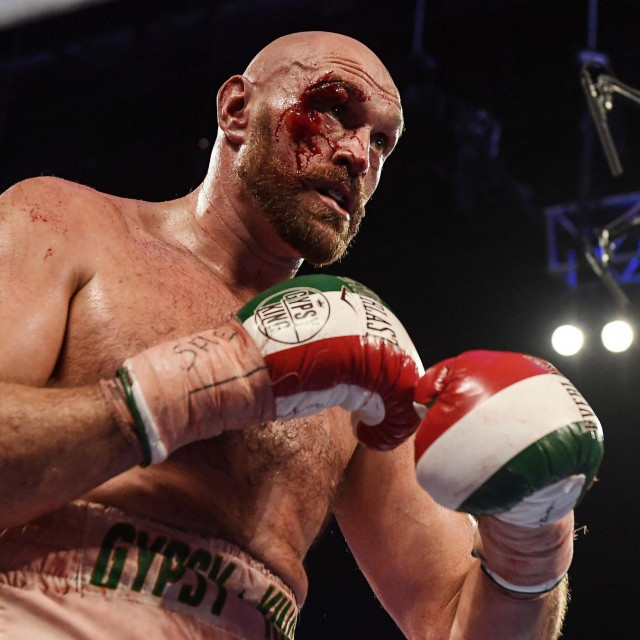 Tyson Fury