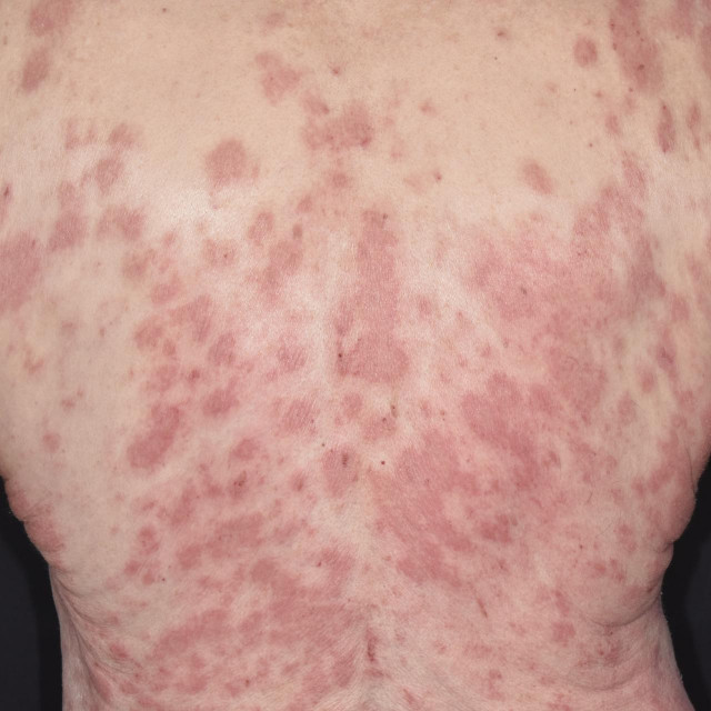 Ilustrativna fotografija