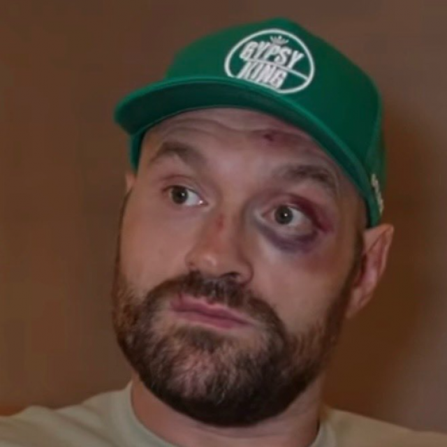 Tyson Fury