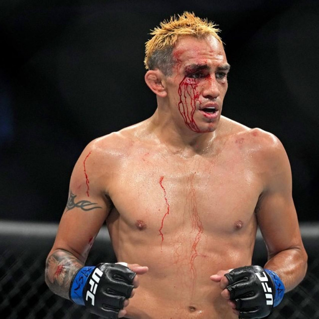 Tony Ferguson