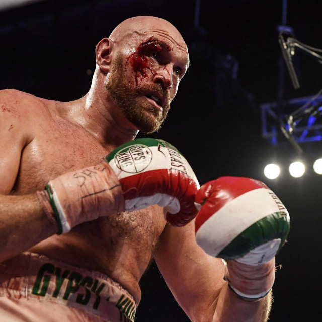 Tyson Fury
