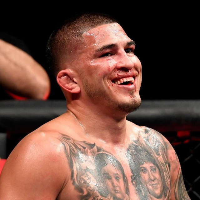 Anthony Pettis