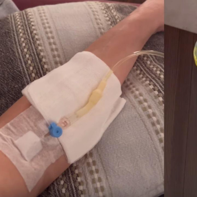 Severina intravenozno prima vitamine