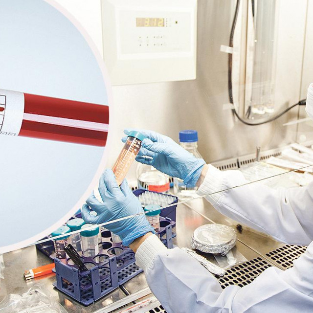 HIV testiranje (ilustracija)