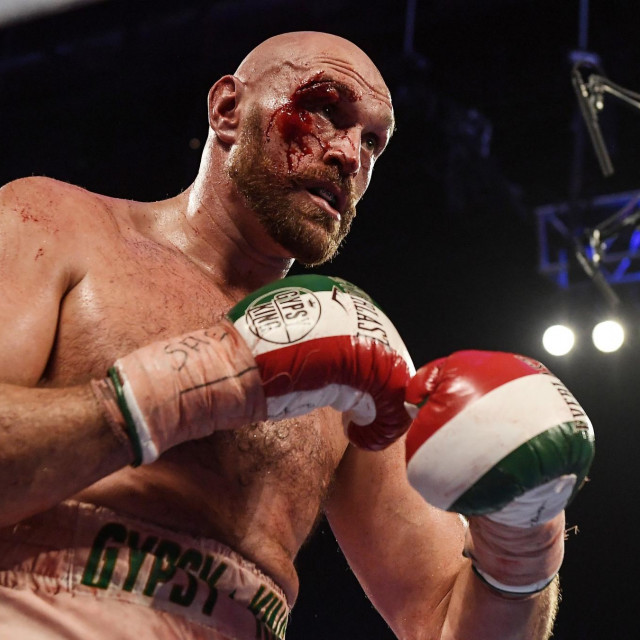 Tyson Fury