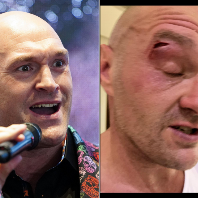 Tyson Fury