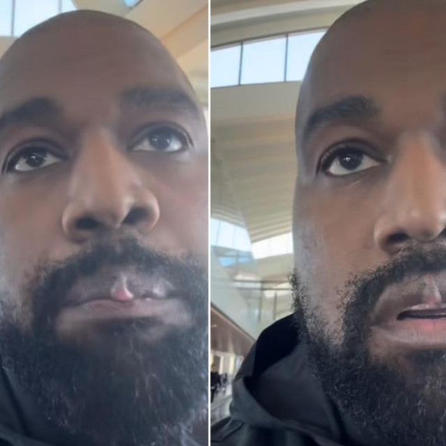 Kanye Westu pojavila se izraslina na gornjoj usnici