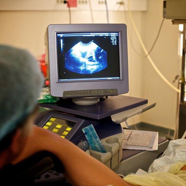 Ilustrativna fotografija