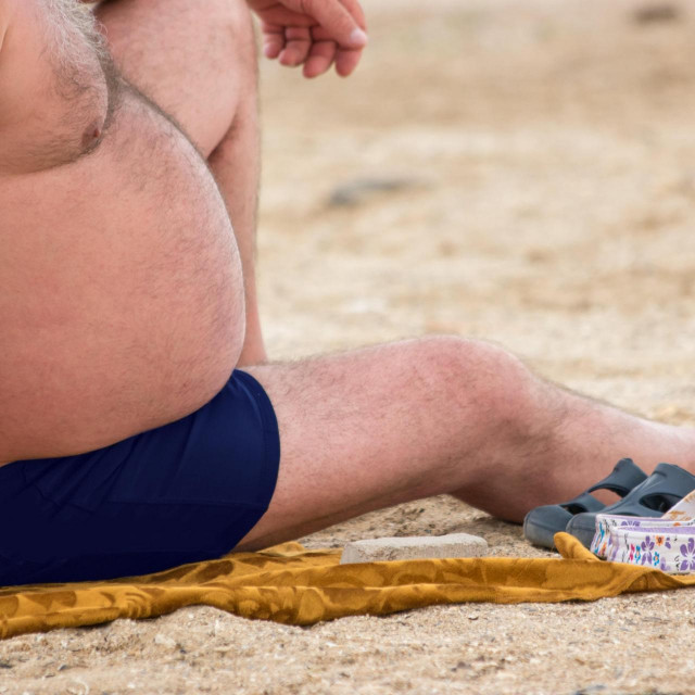 Pretilost, Ilustrativna fotografija