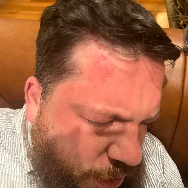 Leonid Volkov, suradnik Alekseja Nvaljnog nakon napada 