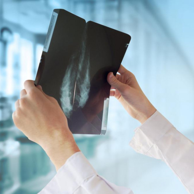 Doctor with Mammography