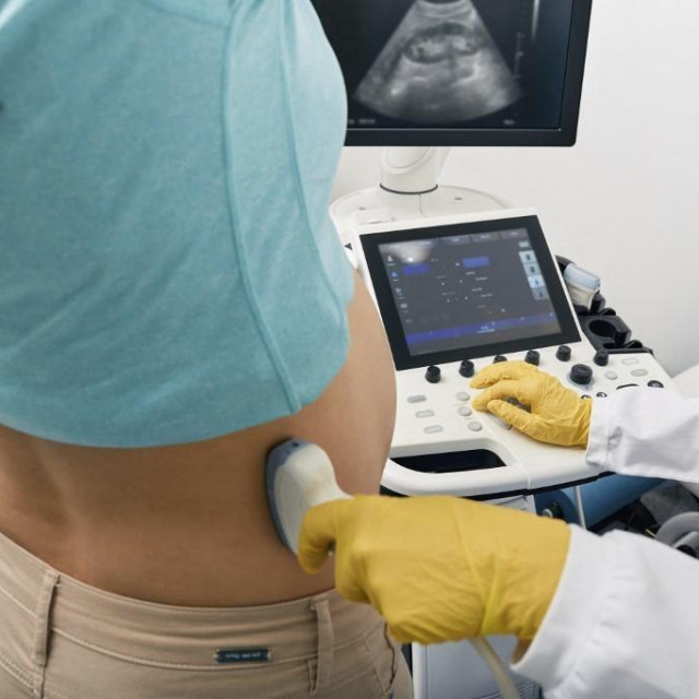 Ilustrativna fotografija