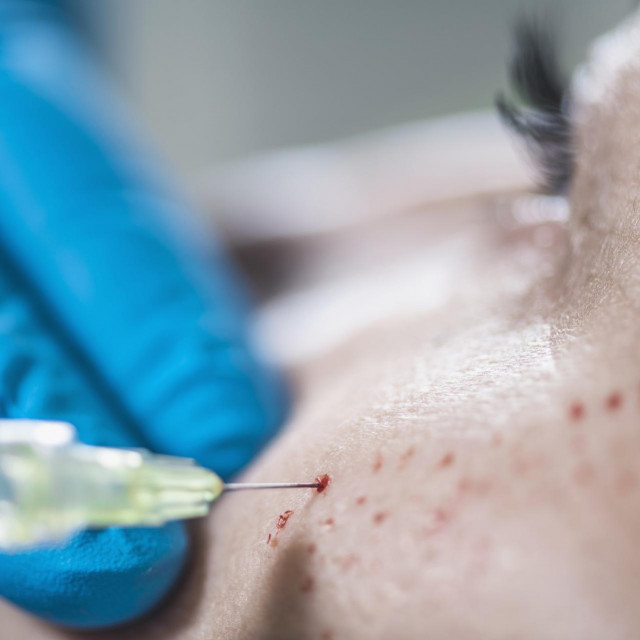 Ilustrativna fotografija