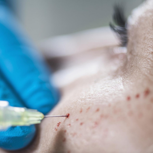 Ilustrativna fotografija