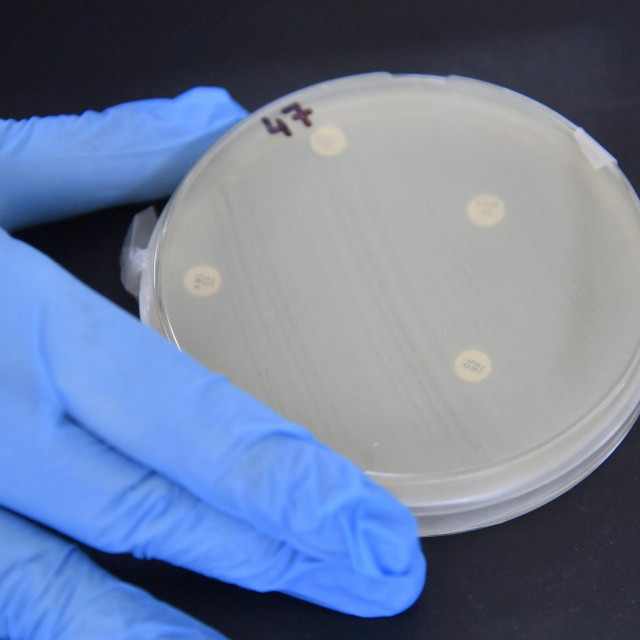 Antibiotici koji se koriste protiv infekcije, a u nekim slučajevima spašavaju i život, imaju i štetne učinke