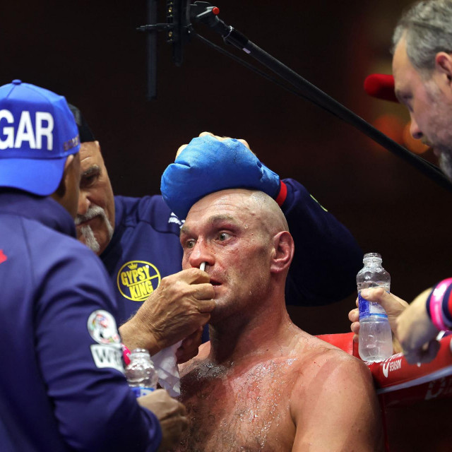 Tyson Fury
