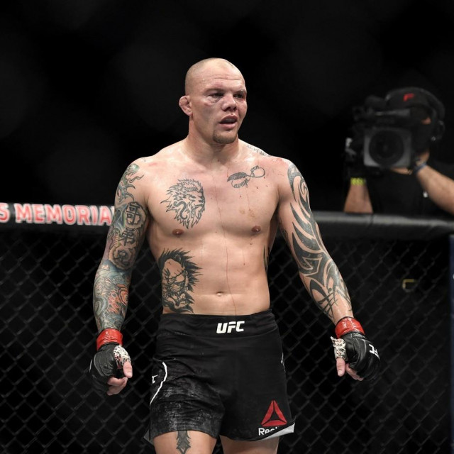 Anthony Smith