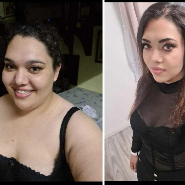 Josipa - prije i poslije