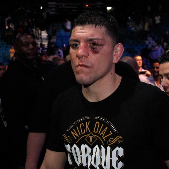 Nick Diaz