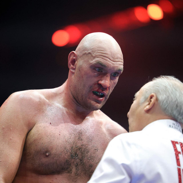 Tyson Fury