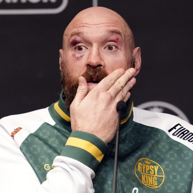 Tyson Fury