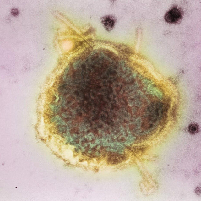 Virus ospica